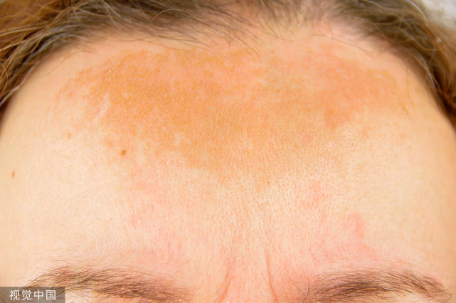 外出旅游时,不要忘了防护紫外线