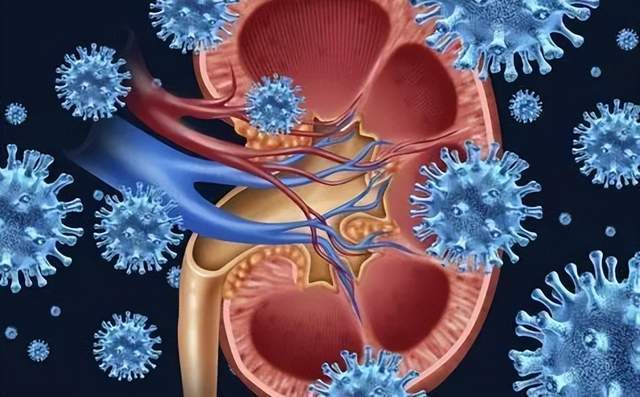 肾炎和肾盂肾炎,都是肾脏发了炎?是一回事吗?_腾讯新闻