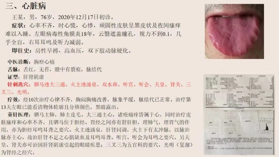 张菁蓉舌问董针技术效果立竿见影