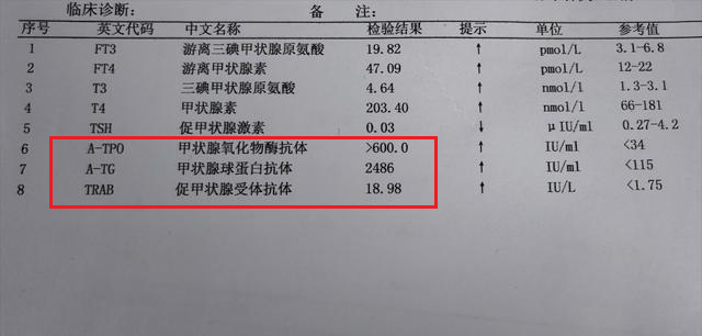 怎么判断自己的甲亢严不严重?