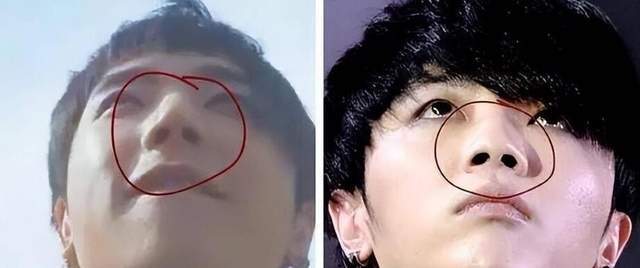 嘴歪,鼻头坏死,下巴凹陷,12位明星的整容后遗症,谁看谁皱眉
