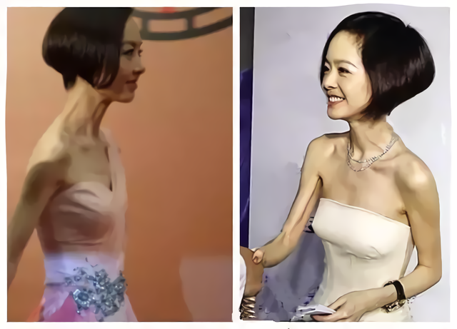 特别是当她们穿上v领礼服的时候,看到的是胸骨突出,特别吓