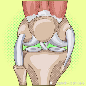 半月板二度損傷要多久才能完全恢復