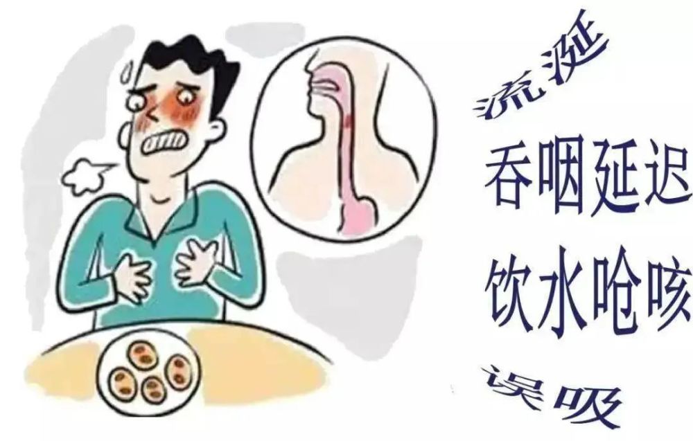 暢意呼吸3065的腦卒中患者存在吞嚥障礙如何安全餵食你需要知道這些