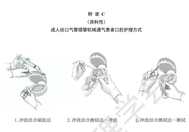 护理团体标准解读成人经口气管插管机械通气患者口腔护理
