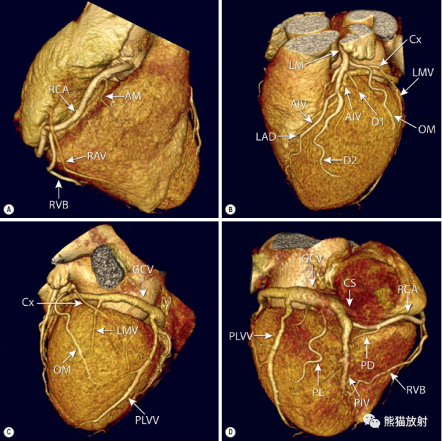 冠狀動脈ct:相關概念,解剖