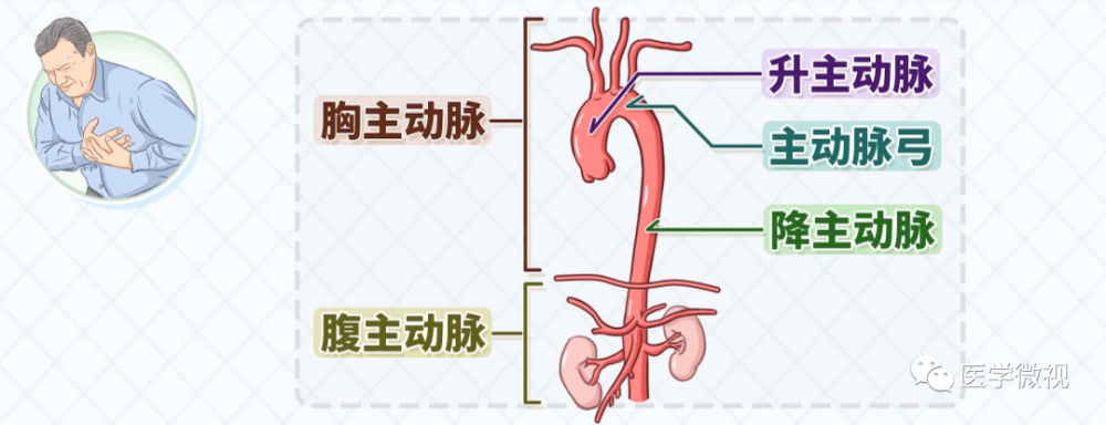 主动脉是从心脏发出的大血管,从解剖部位来看,依次为升主动脉,主动脉