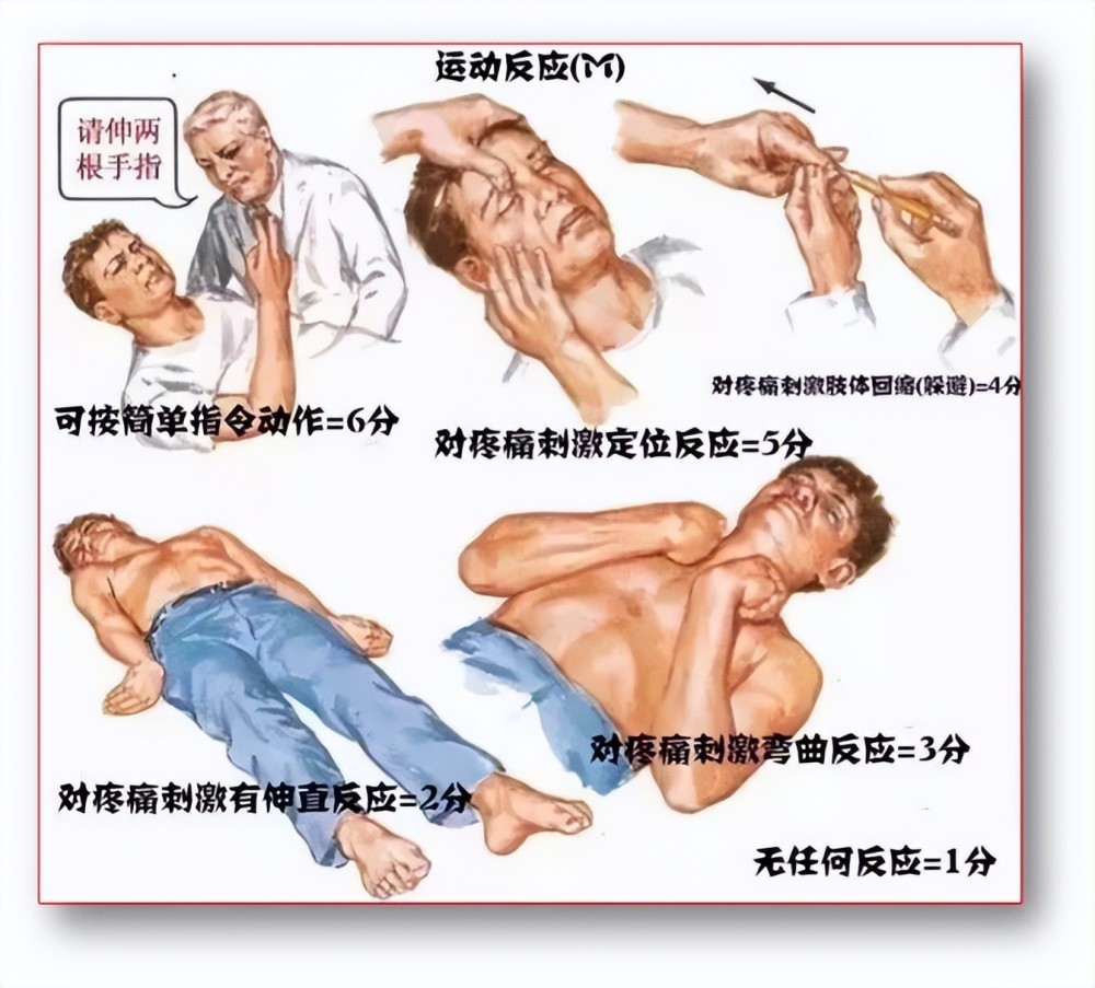 图说格拉斯哥昏迷评分法