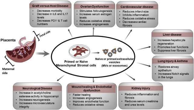 胎盤間充質幹細胞可解決各系統疾病,挽救眾多生命