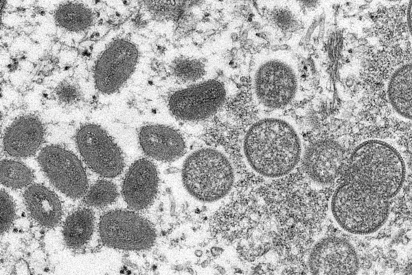 白宫新冠疫情协调员：猴痘病毒传播和新冠明显不同在美感染还会扩大