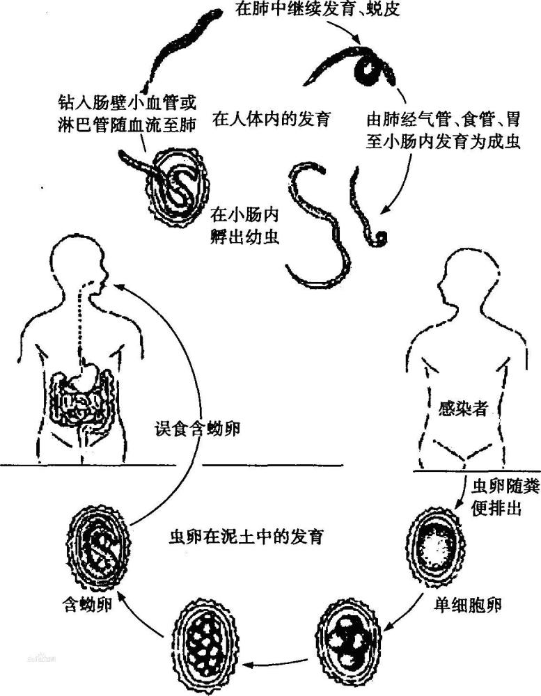 八九十年代,幾乎人人肚子裡都有蛔蟲,為什麼現在沒有了?_騰訊新聞