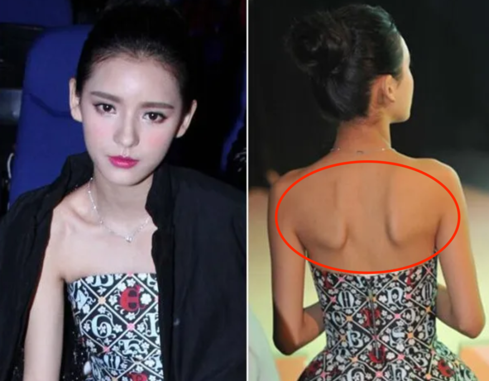 娱乐圈的病态审美热巴的蝴蝶骨钟楚曦的直角肩都不值得吹捧