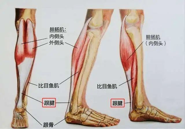 跟腱是由小腿后方肌群腓肠肌,比目鱼肌和跟骨的带状肌腱纤维共同组成.