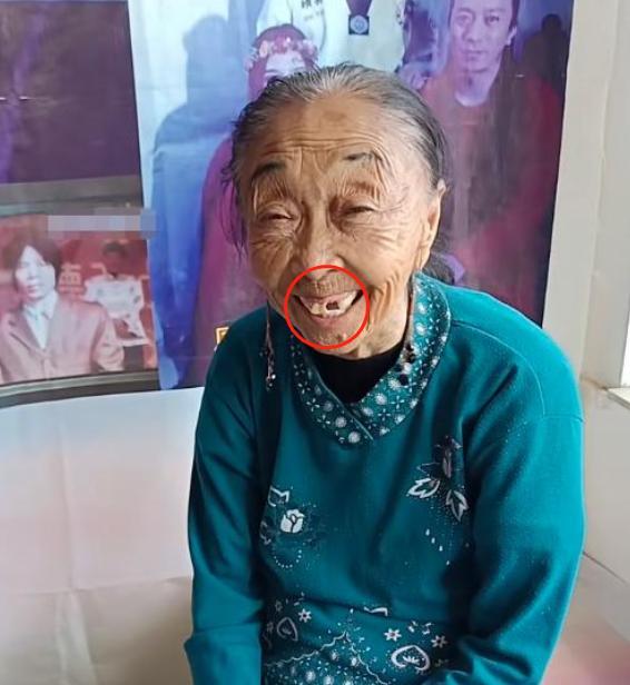 85歲馬玉琴吃燉排骨雙眼呆滯只動嘴門牙也掉了一顆