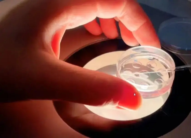 胚胎冷冻后丈夫去世,女子要求医院继续实施手术却遭拒