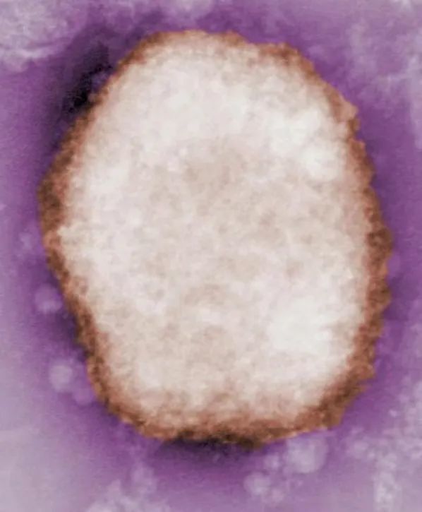 多国报告人类感染猴痘病例，这6个问题你需要知道孜然炒鸡心的做法