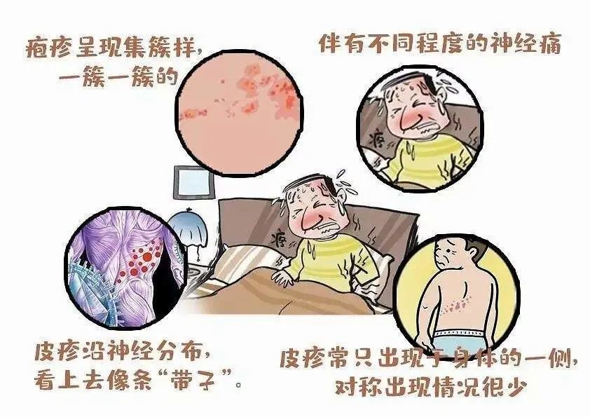 沾衣欲湿杏花雨沾衣剧痛是疱疹