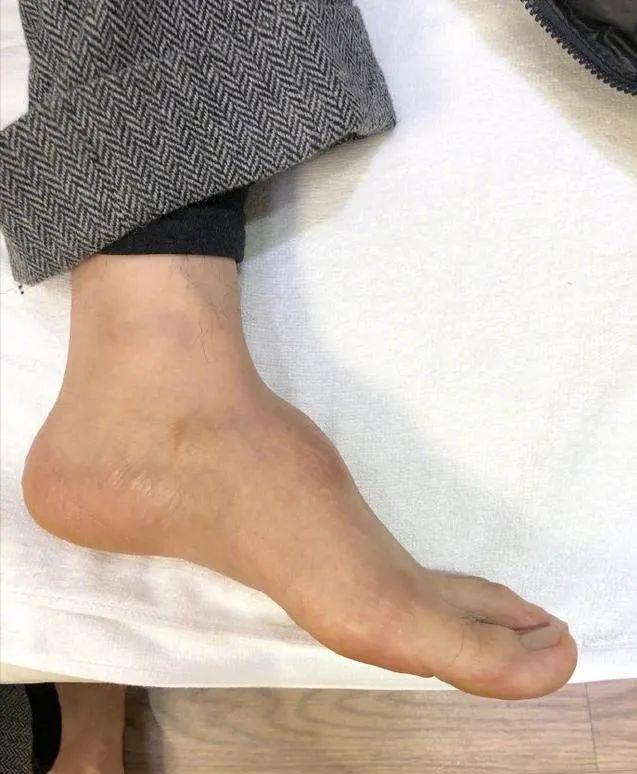 网友这才恍然大悟,原来,黄晓明并不是为了耍帅,只是想让自己的脚更