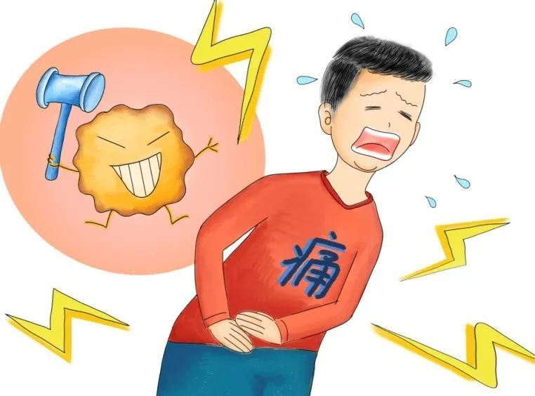 泌尿系统结石知多少