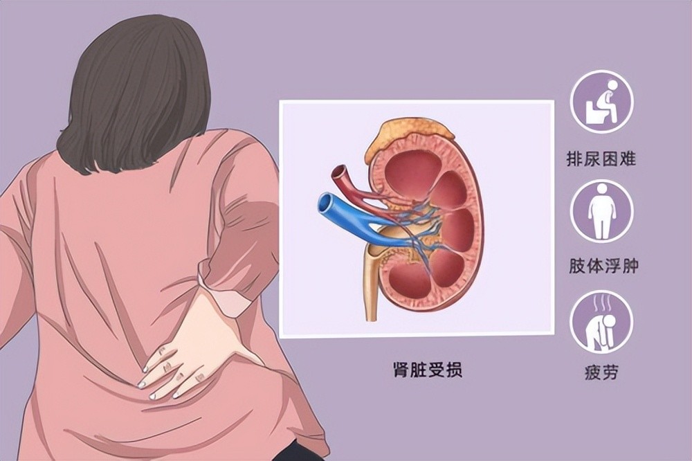 肾病综合征为什么会发生血栓?合并"血栓"的危险因素有哪些?_腾讯新闻