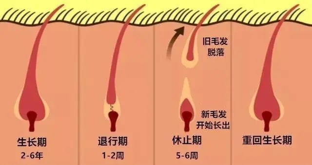 而不可逆性脱发一般是指头皮受到外界的严重刺激后,导致毛囊死亡,这种