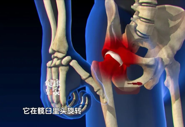 两大原因可造成股骨头坏死出现5种情况可能就危险了