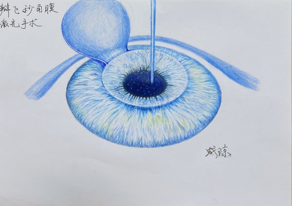 为做好精细手术苦练左手作画,眼科医生手绘眼病图谱实力圈粉_腾讯新闻