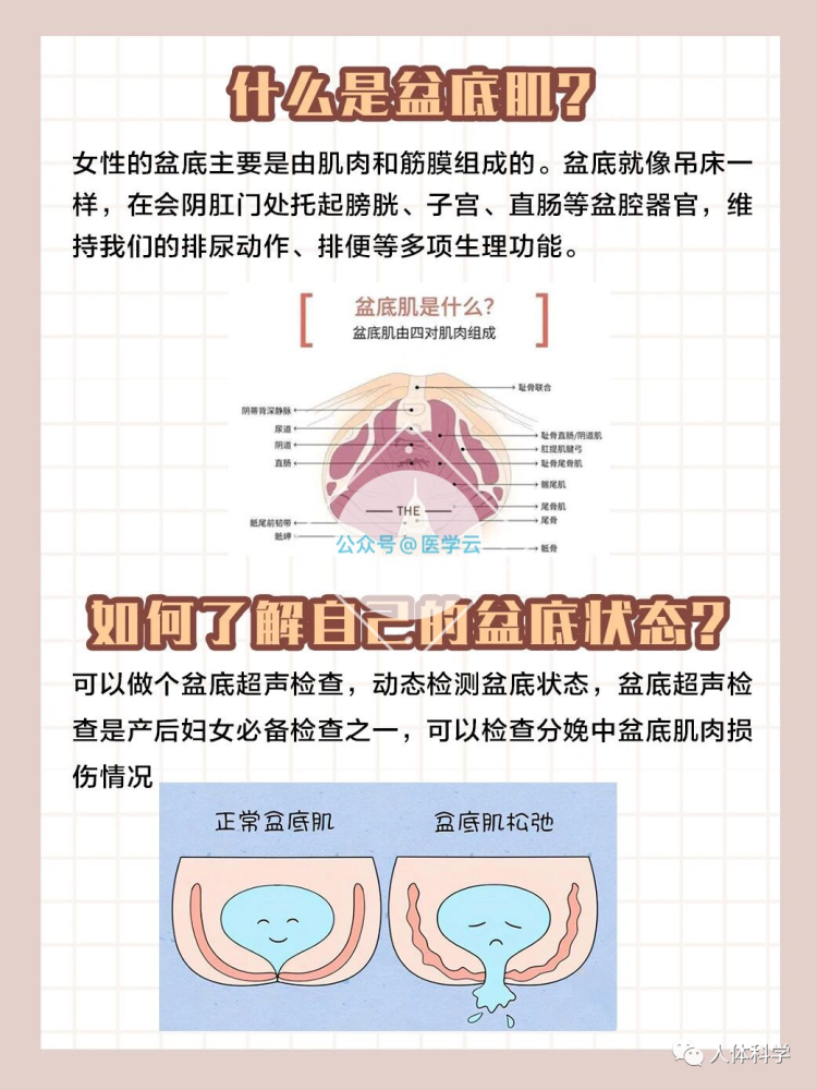 產後修復盆底肌修復注意事項