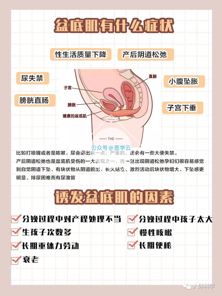 產後修復盆底肌修復注意事項