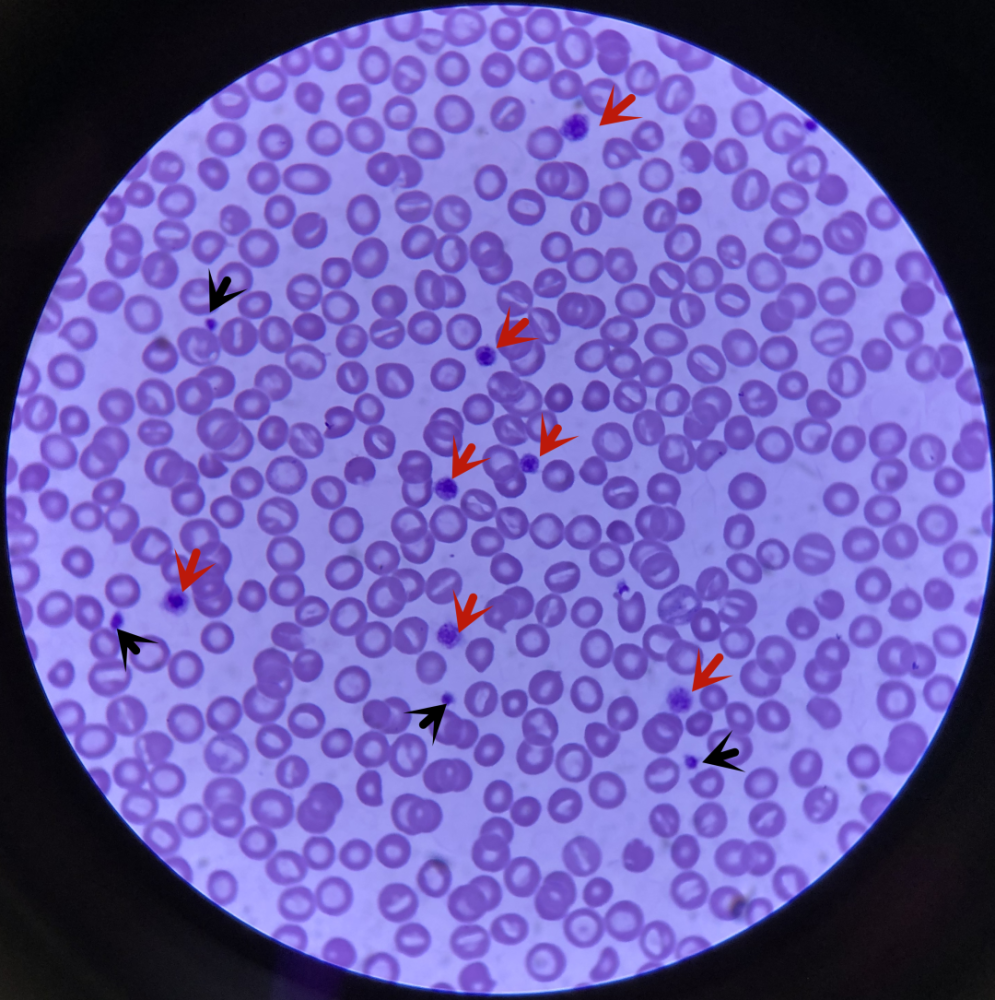 大便红细胞图片