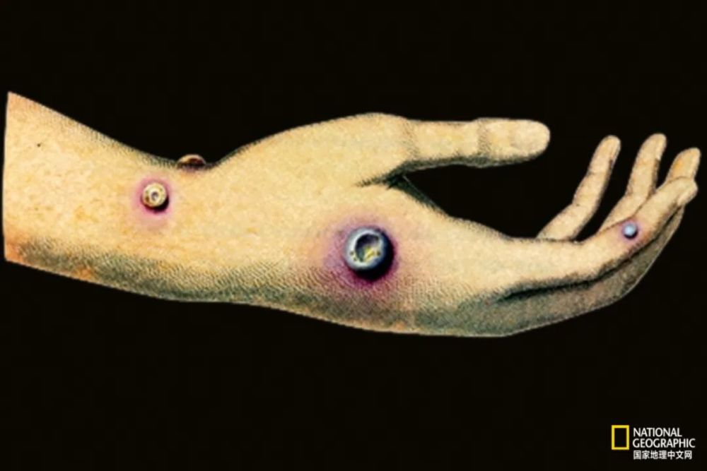 天花病毒界的天花板