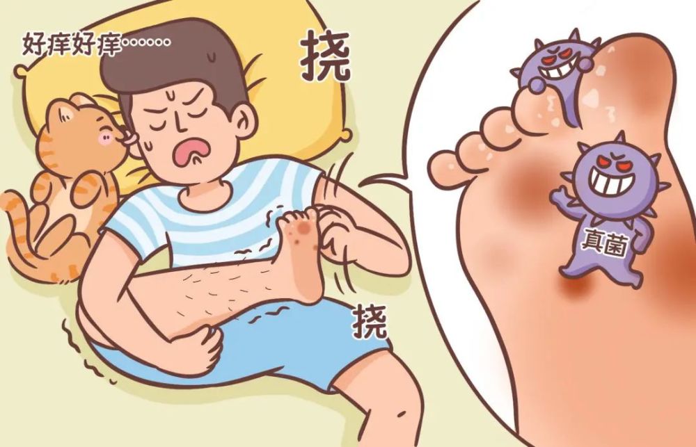 脚脱皮起水疱奇痒无比到底怎么办