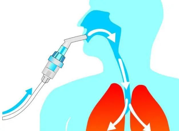 慢阻肺哮喘患者急性发作怎么办这种急救治疗方法家庭也能用
