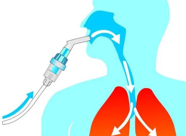 慢阻肺哮喘患者急性發作怎麼辦這種急救治療方法家庭也能用