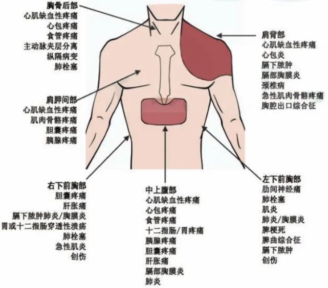 以下常見的是呼吸性胸痛,指在呼吸時可以感到輕微或極端的不適或疼痛