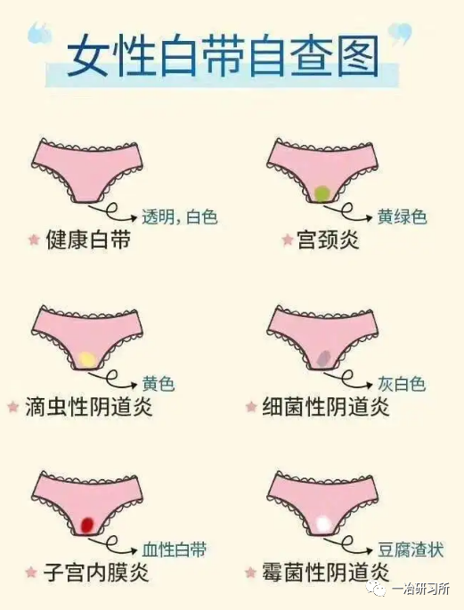 白带过多是病态过少也是病态那到底多少合适