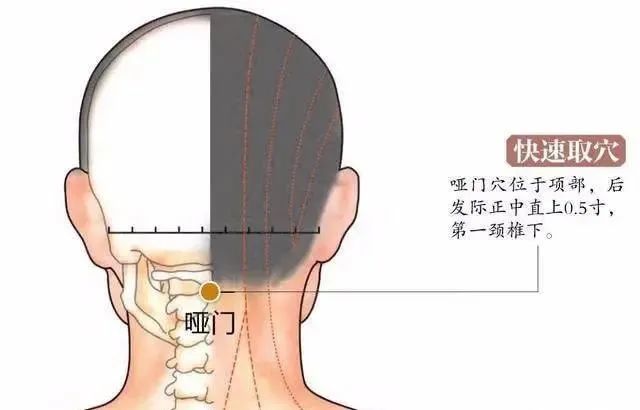 哑门穴缓解舌缓不语音哑头重头痛