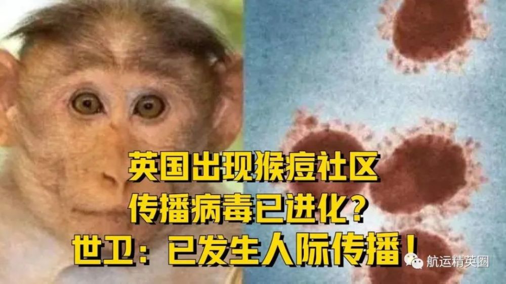 猴痘已在歐洲發生大規模社區傳播