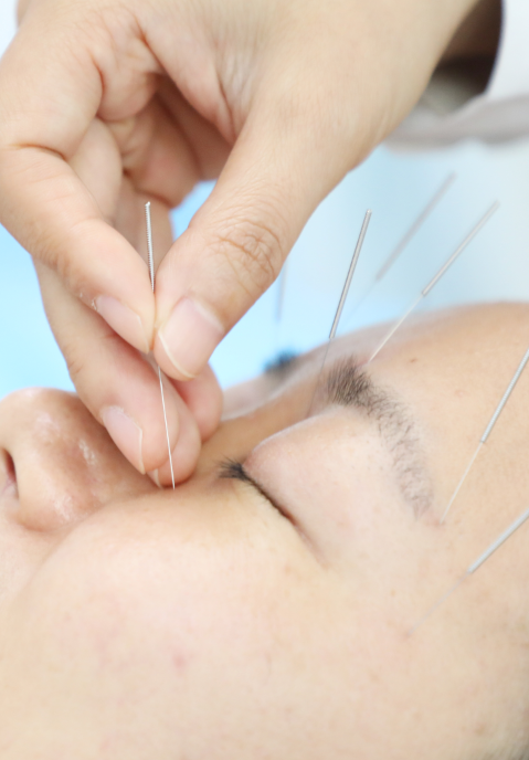 岐黄名医说丨中医助你轻松应对干眼症