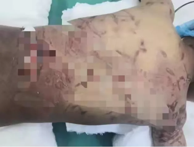 11岁男孩疑似被狗咬死,警方回应!