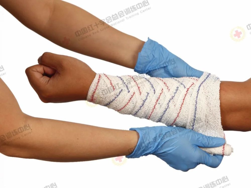 救在身边现场包扎技术之绷带螺旋反折包扎