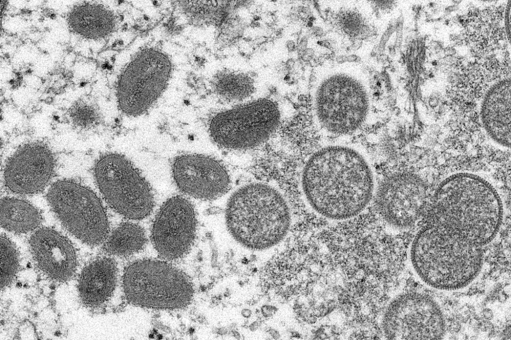 美国军方报告首例猴痘病例为一名驻德国现役军人菲利普德瑞斯原型