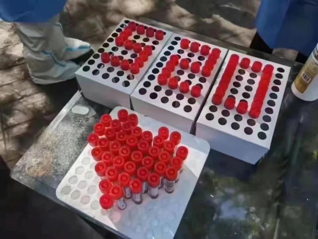 20"有点特别,各种别具特色的图片,特别是用核酸检测试管做成的数字和