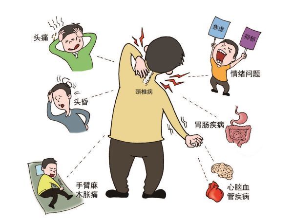 直乐大讲堂:颈肩疼痛僵硬还头晕?原因在这里