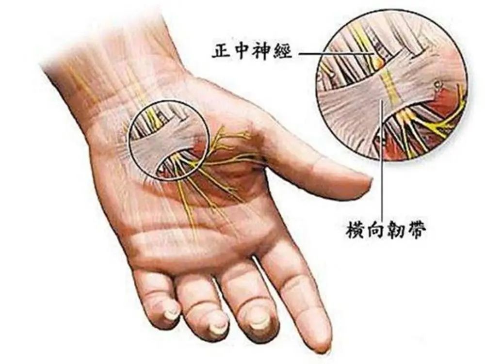 所有人严重可导致肌肉萎缩鼠标手判断和预防方法了解下