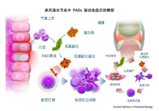 类风湿性关节炎机制图片