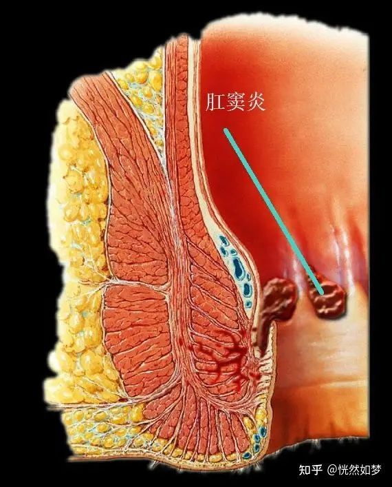 包含肛奸的词条