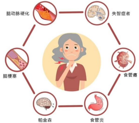 防范老年人发生噎食提高警惕