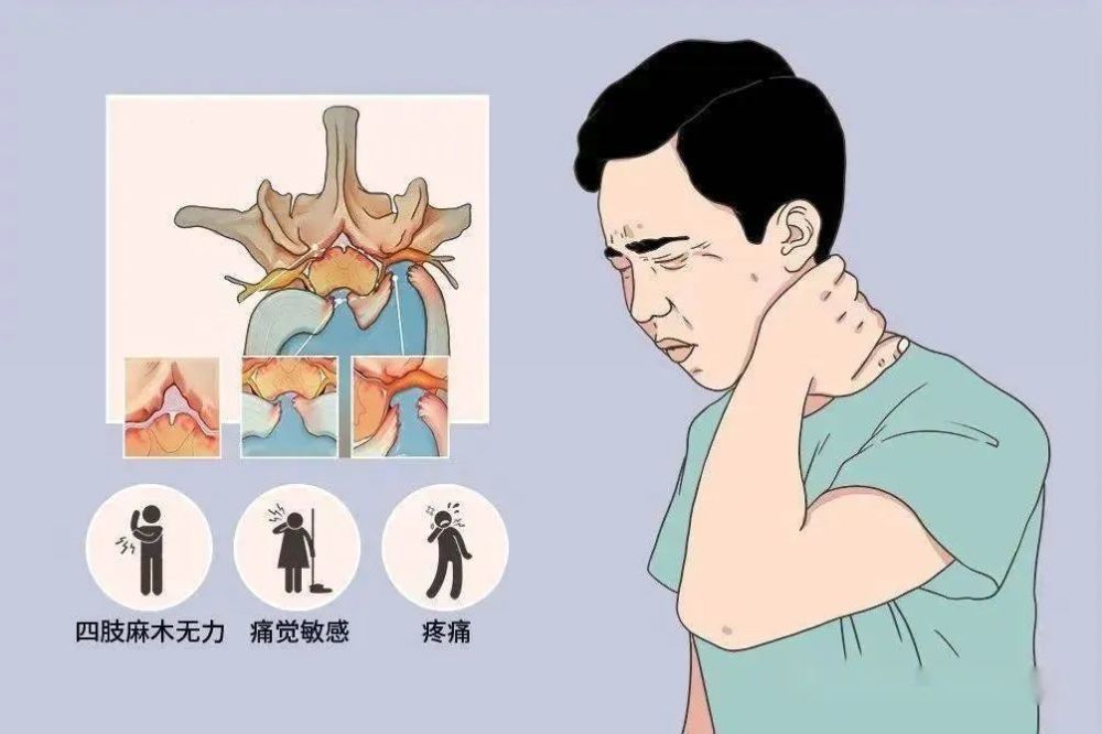 重慶看頸椎病好的醫院重慶骨科比較好的醫院重慶紅樓醫院