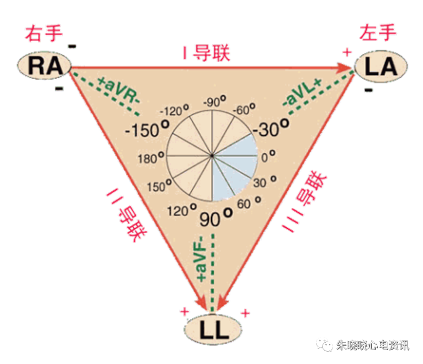 心电轴的测量方法你掌握了几种